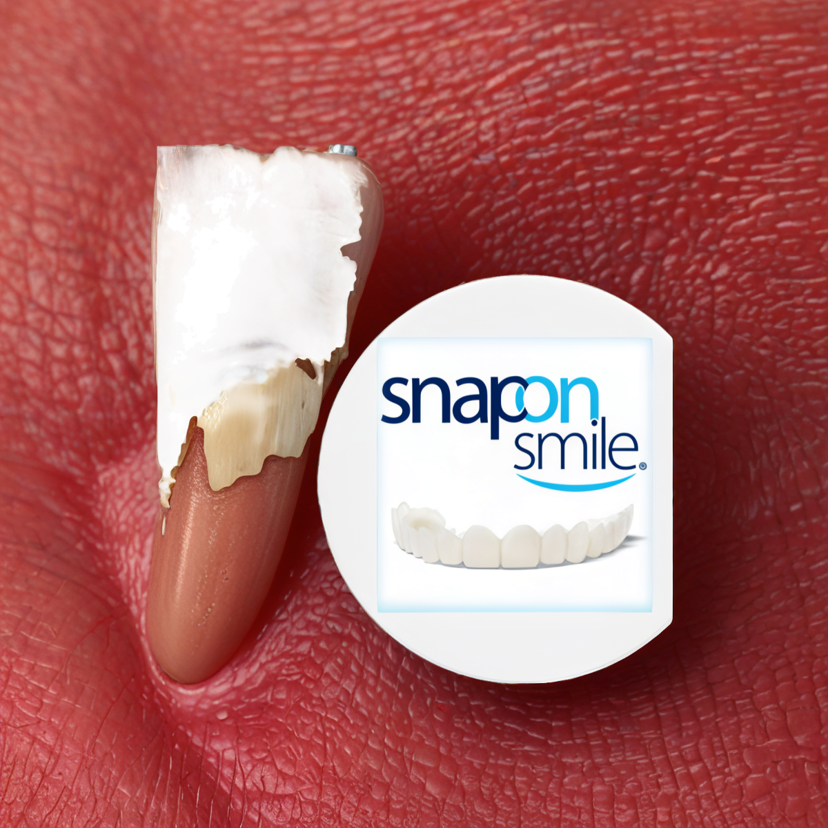 Snap-On Smile